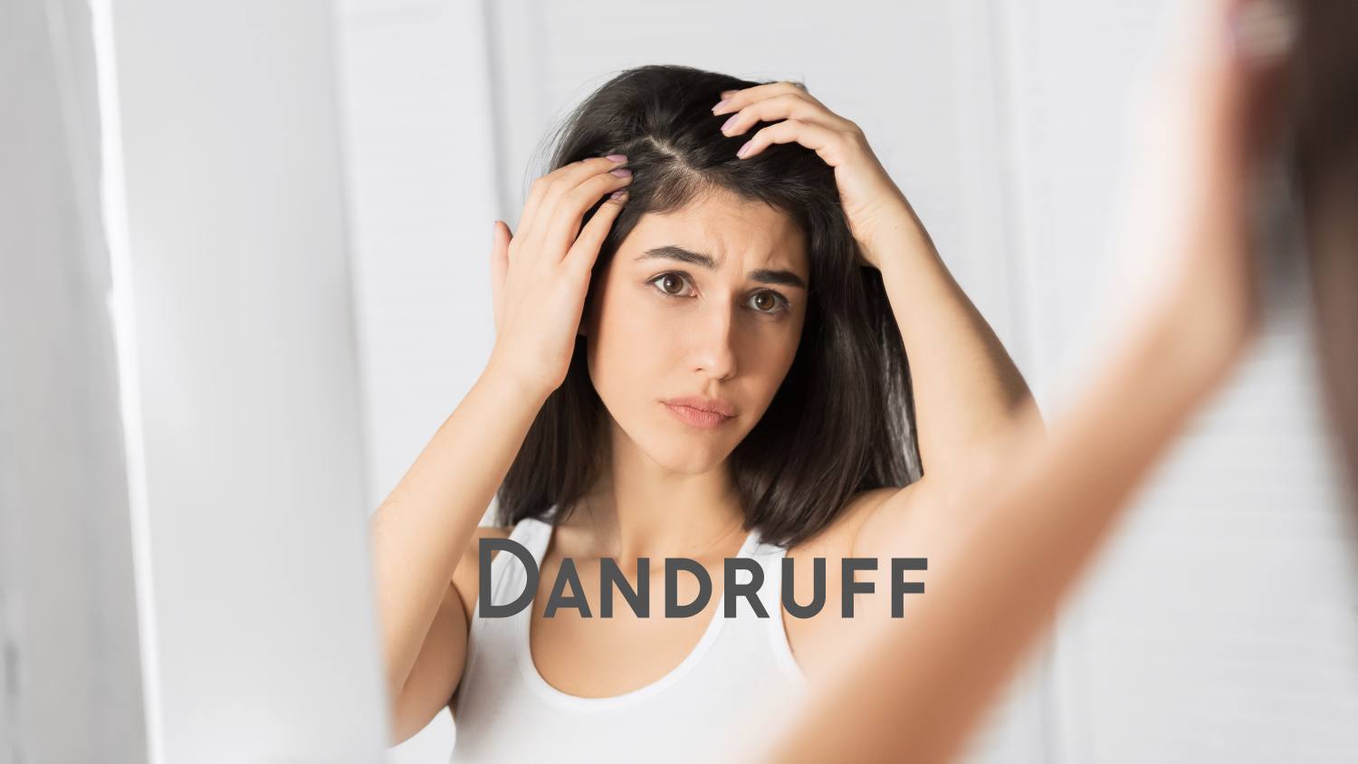 10 Home Remedies for Dandruff