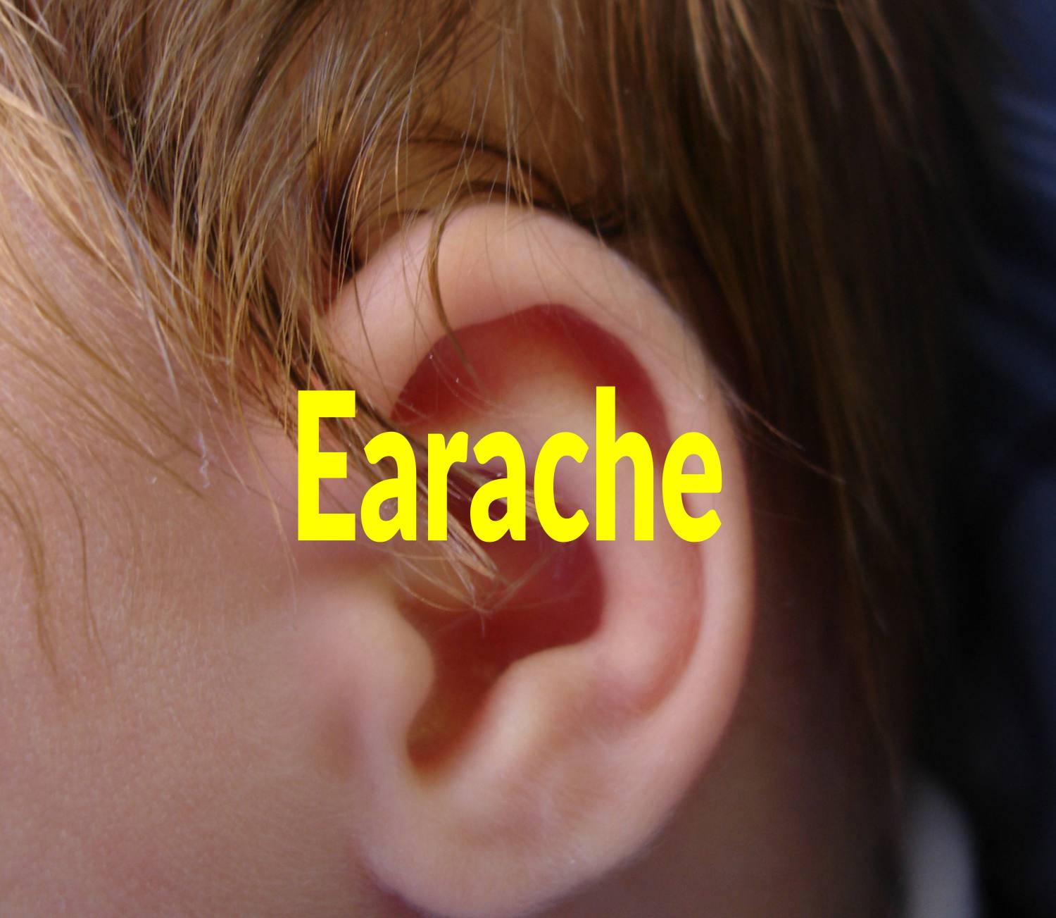 10 Home Remedies for Earcache