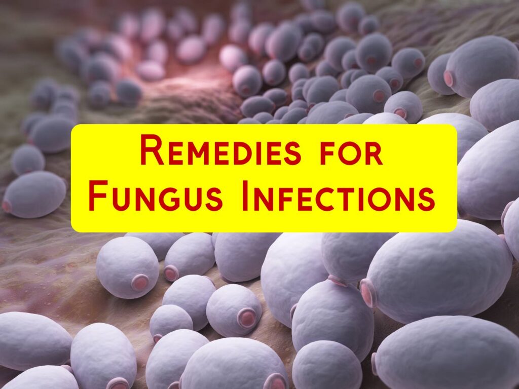 10 Home Remedies For Fungal Infection Home Remedies App 