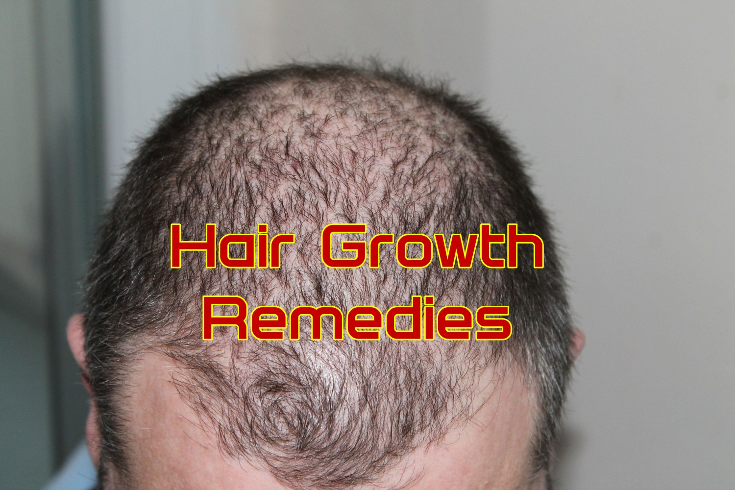 10 Home Remedies for Hair Growth