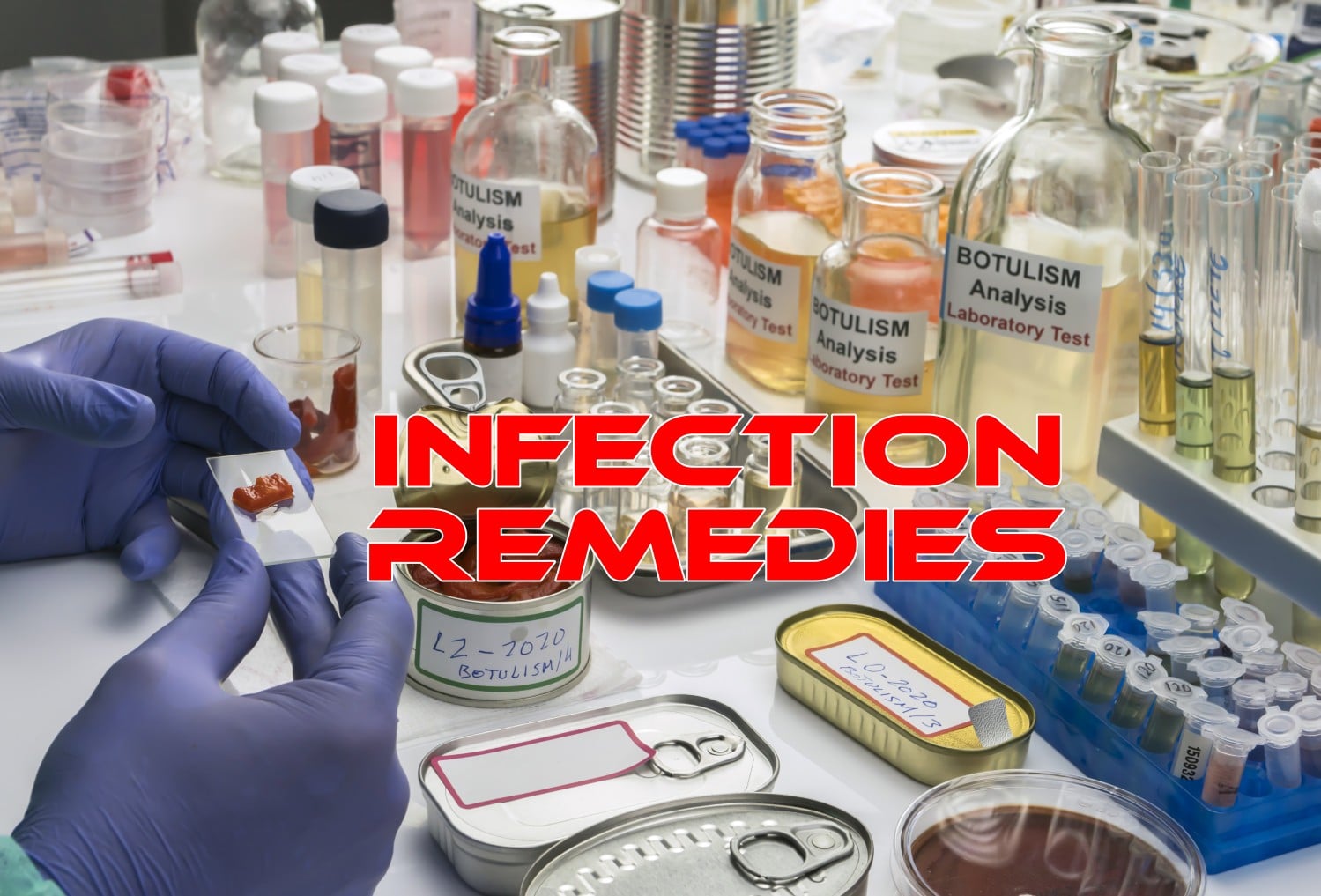10 Home Remedies for Infections