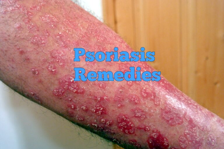 10 Home Remedies for Psoriasis - Home Remedies App