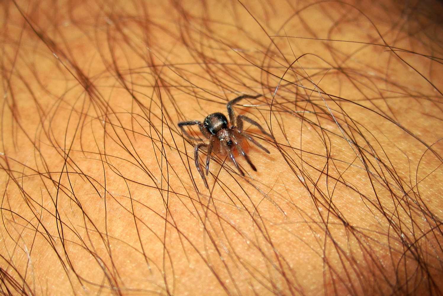 10 Home Remedies for Spider Bites